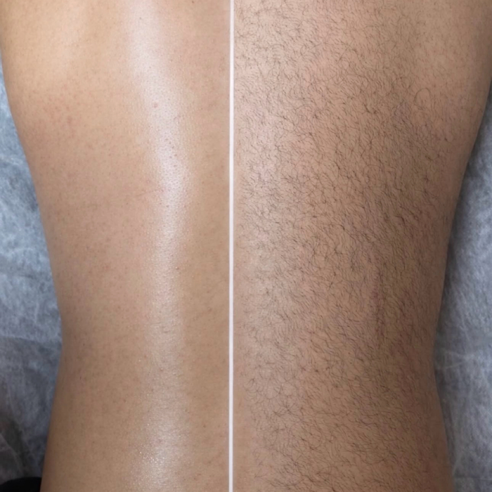 Back Hair Waxing Removal at Amethyst Spa in Omaha, NE
