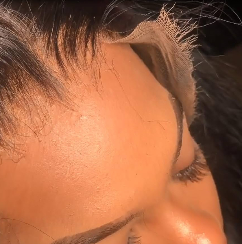 Skinlike HD Closure at RSBK