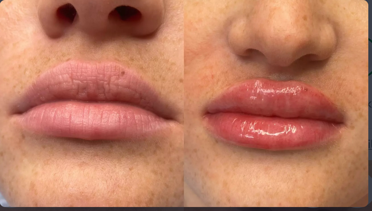 LIP BLUSH TOUCH UP