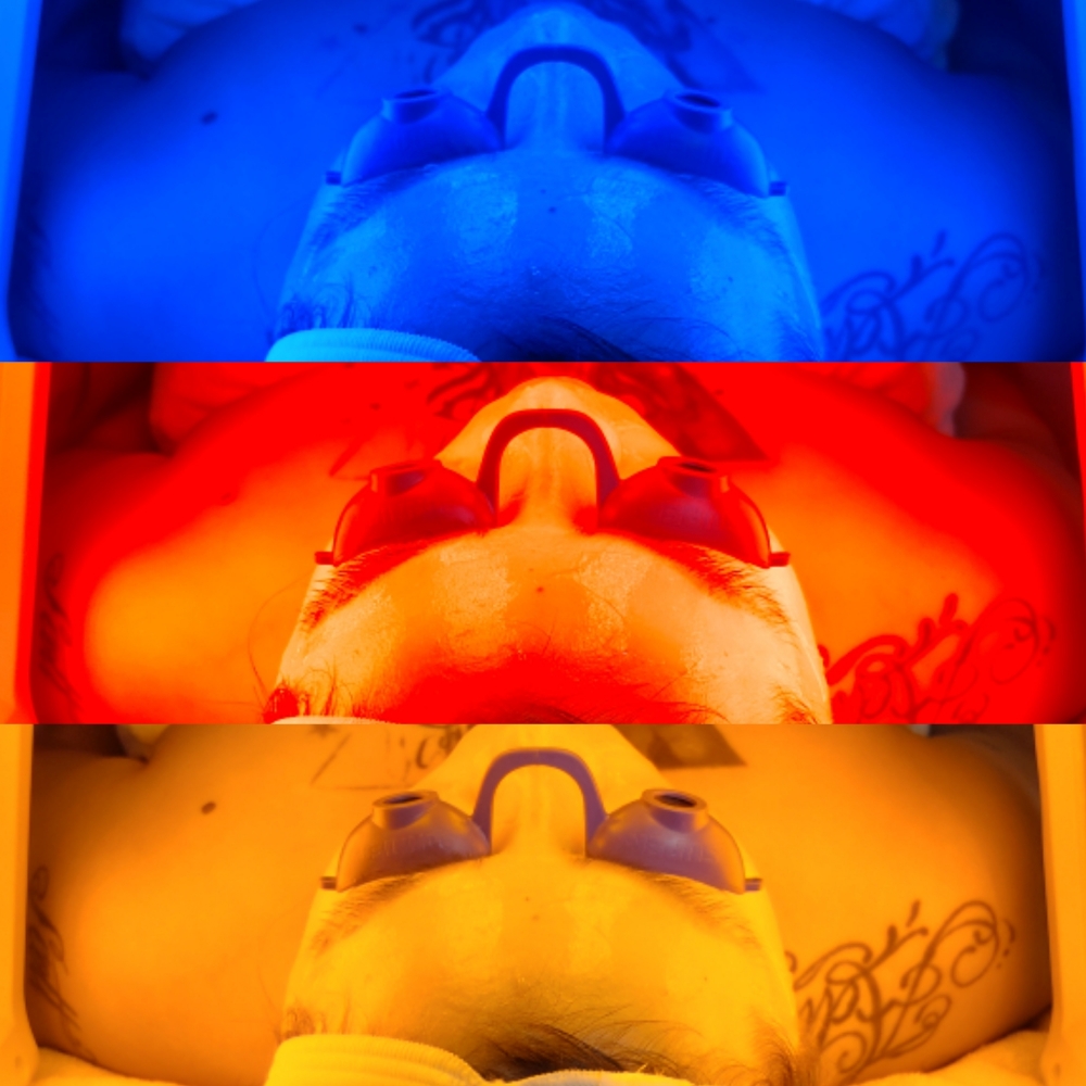 Light Therapy (Avail. As Add On)