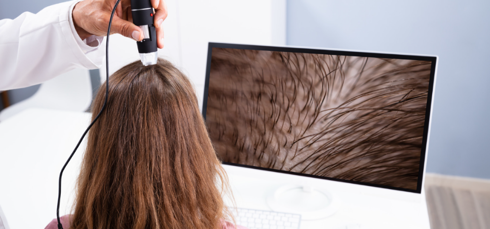 Hair Loss Recovery  Consultation