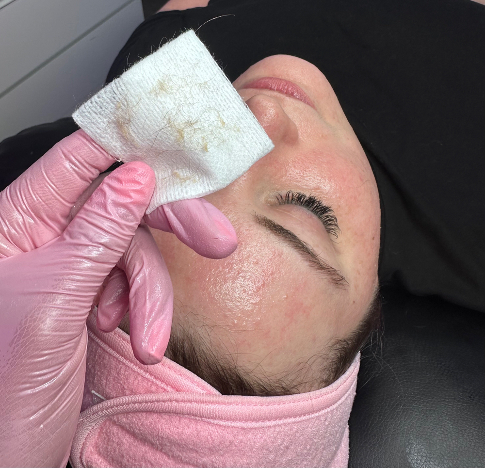 Dermaplane