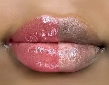 Hydrating Lip Treatment