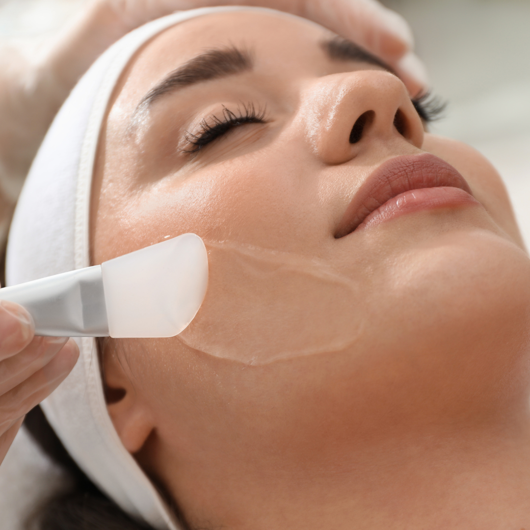 Chemical Peel with Kit