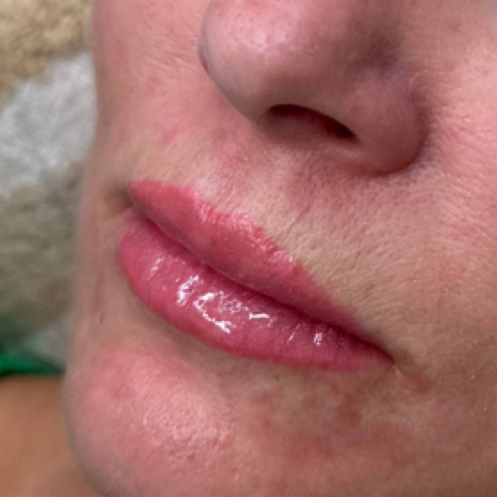 Touchup Non-initial Client - Lips at WINK in Plover, WI