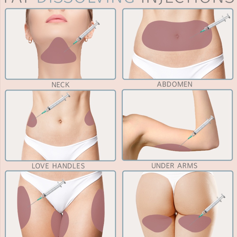 2 Session Mesotherapy Lipo & RF at Luscious Tox Aesthetics in Arlington, TX