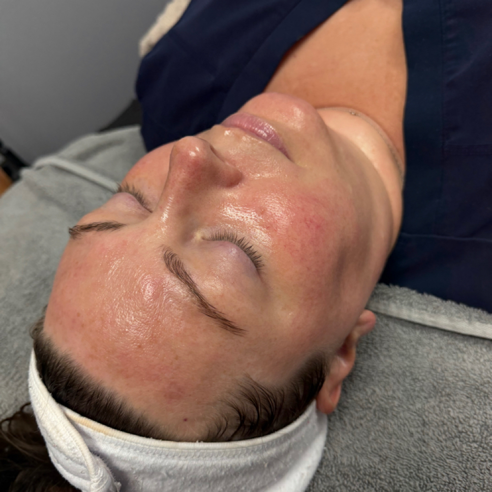 Glacial Gloss at Skin Therapy By Chloe in Bloomington, IN
