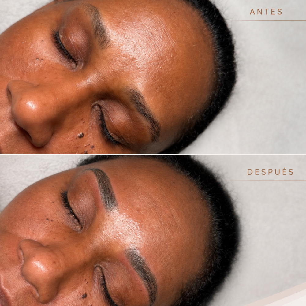 EYEBROW MICROPIGMENTATION at THE BEAUTY SPACE in Dorchester, MA