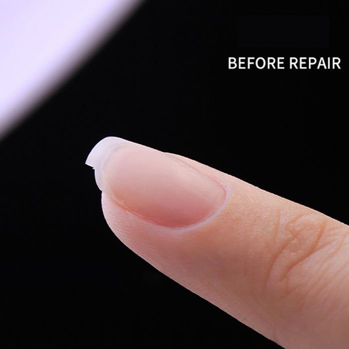 Nail Repair at Bpocare in Tampa, FL