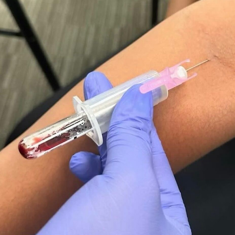 ULTA LABS at Precision skin and Wellness Lab in Tallahassee, FL