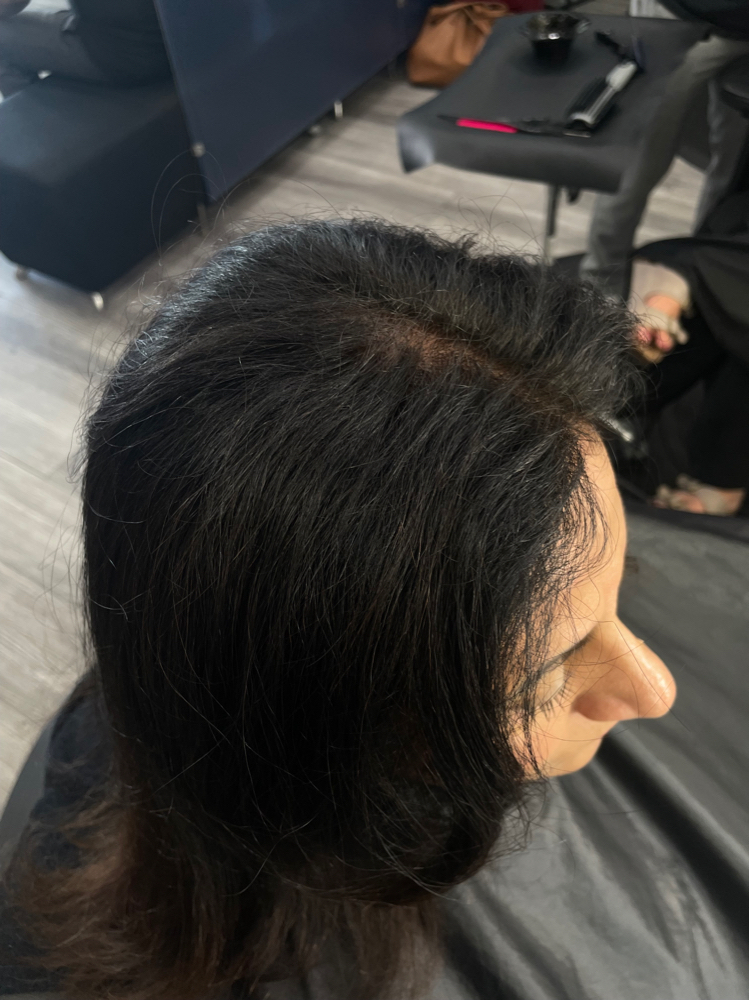 Root Touch Up