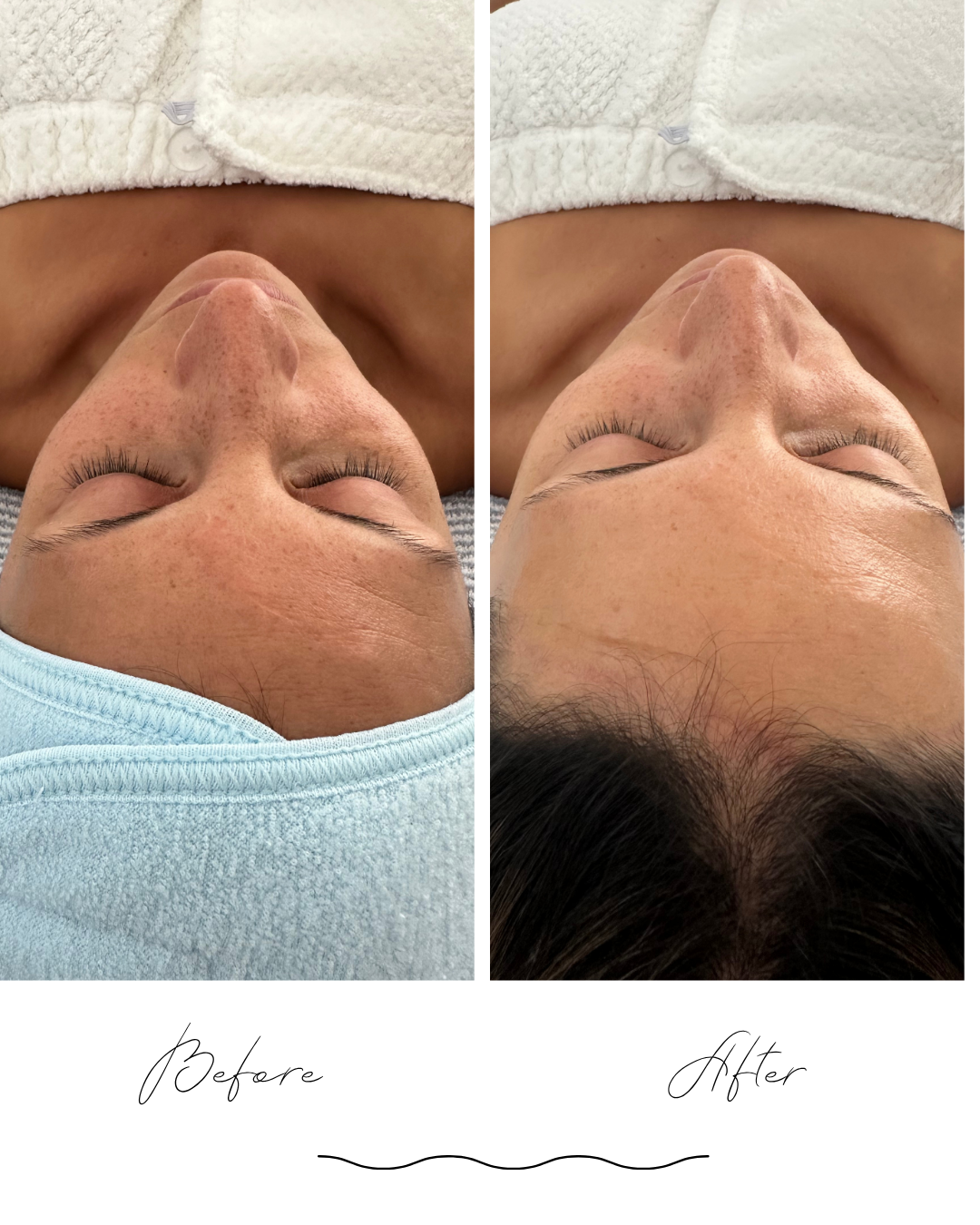 Circadia - Anti-Aging Facial