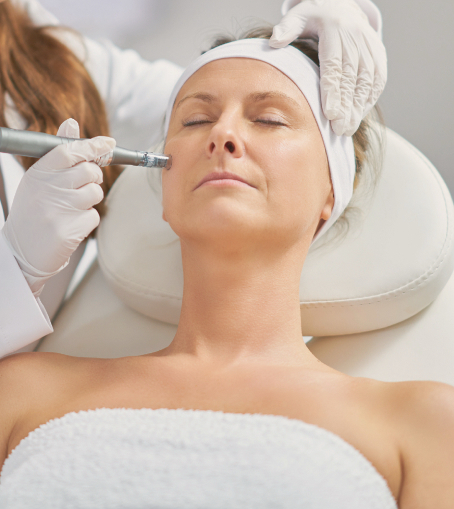 Microneedling Series Of 3 -Discount