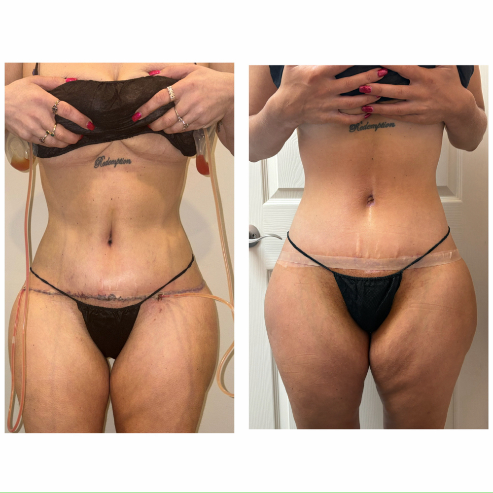 Mobile Gemz Post-Op Recovery at Therapeutic Gemz in Garner, NC
