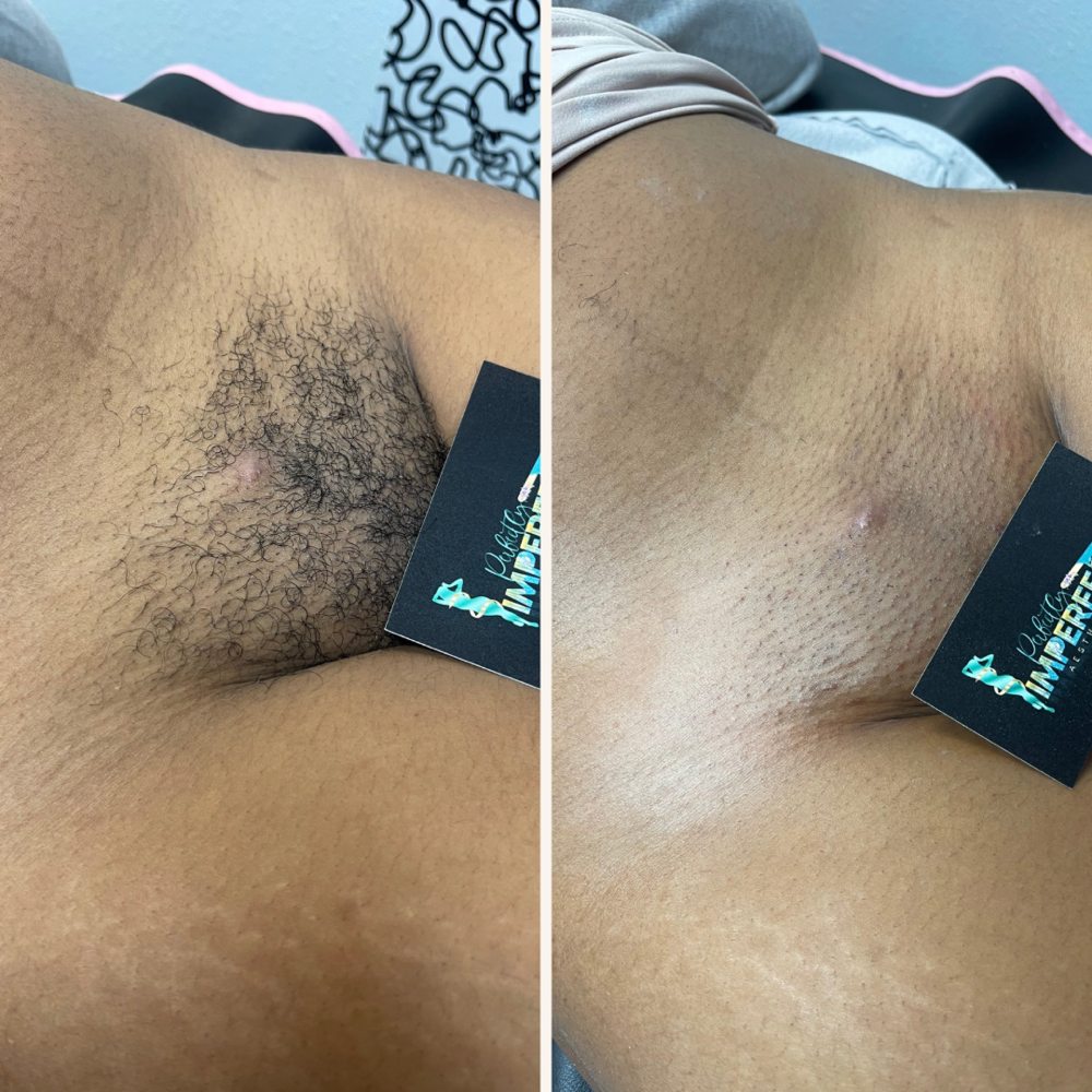 New Client Brazilian Wax