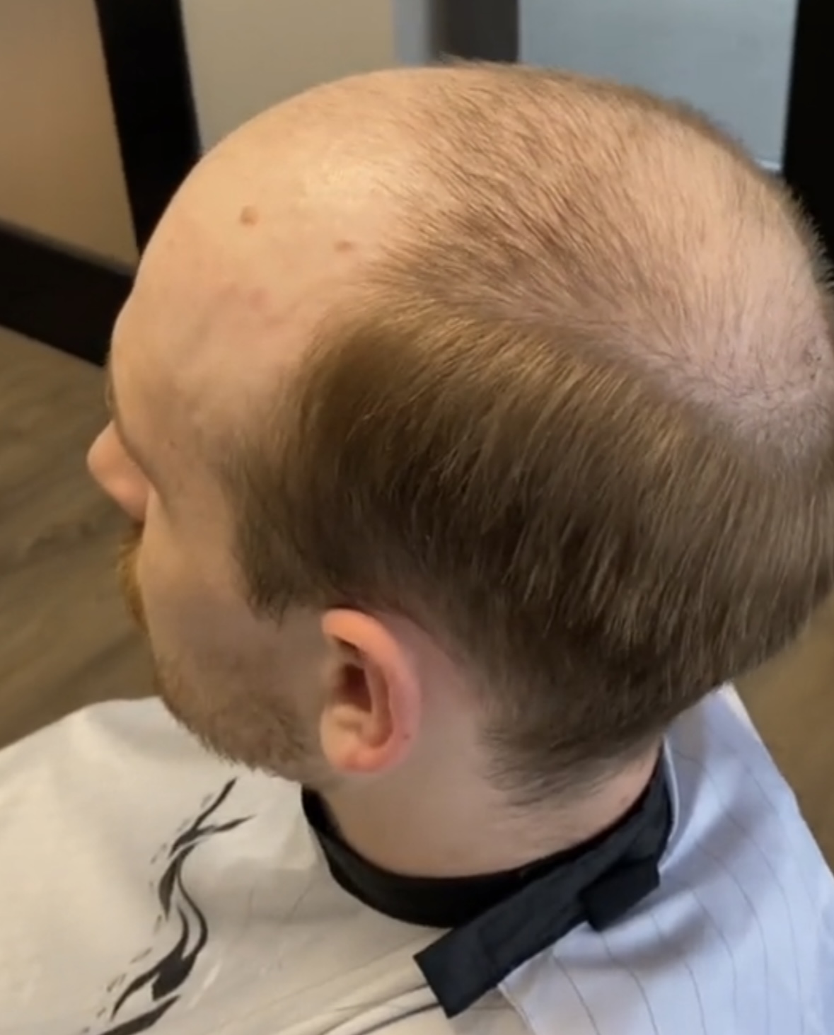 Hair System Maintenance