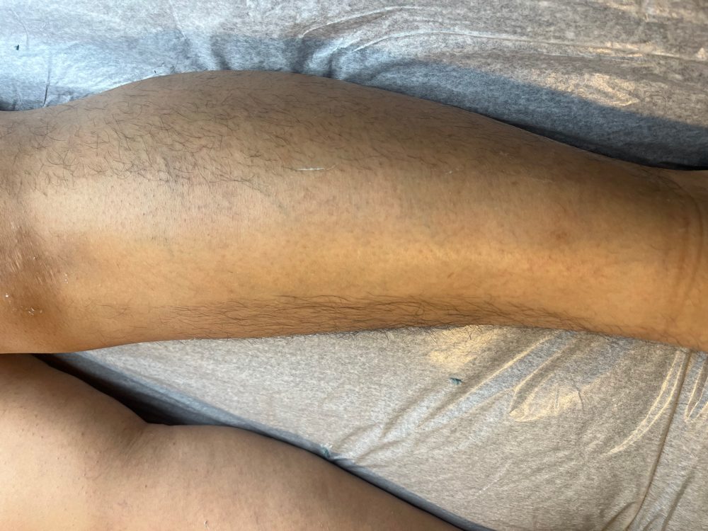 Leg Wax