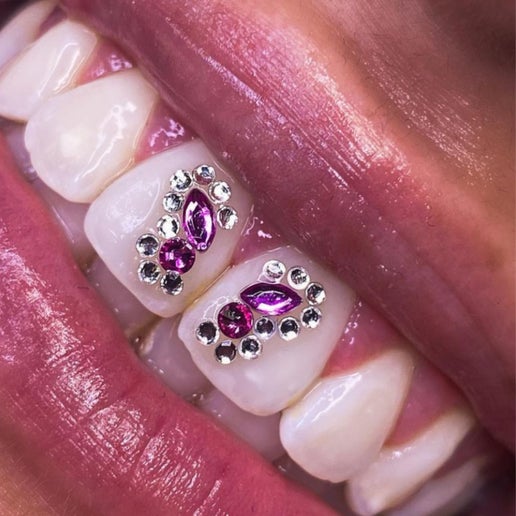 Tooth Gems & Charms