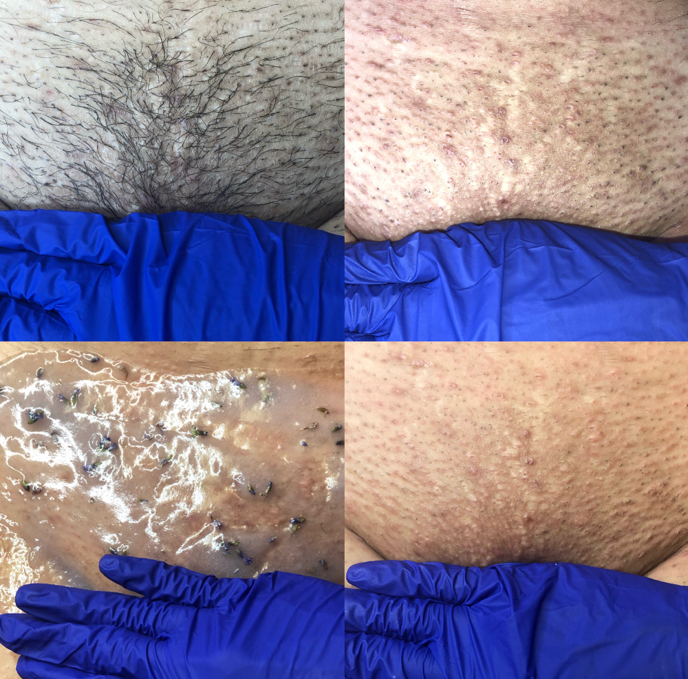 Wow Wax | Luxe Bare