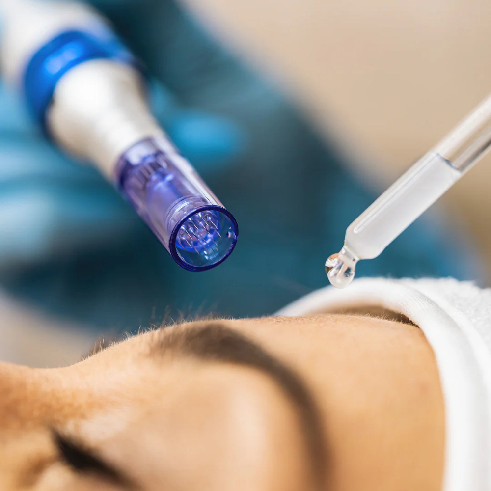 RESTAURACIÓ DE CEJAS