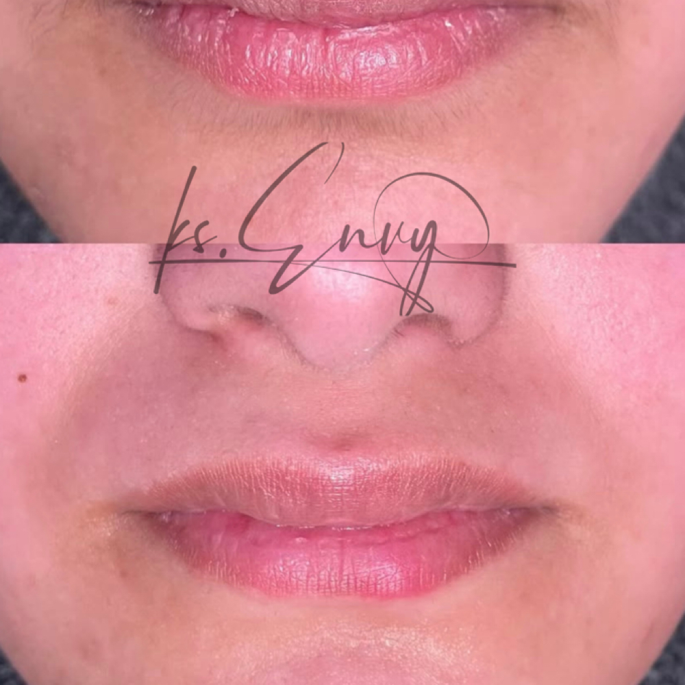 Face: Lip (Lower) at KS.Envy in Columbus, OH