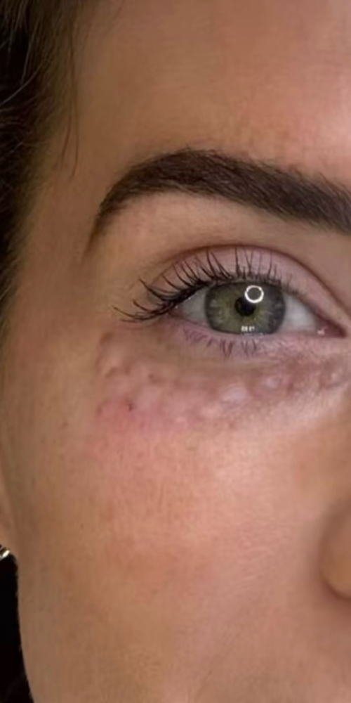 NCTF Under Eye Treatment