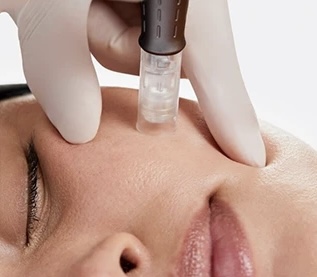 Microneedling Facial