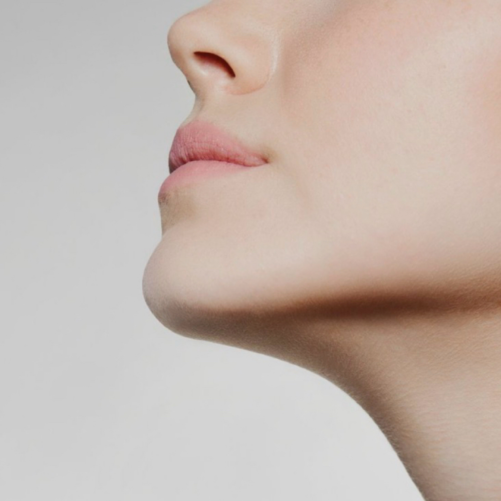 Chin at Imperial Esthetics in Raleigh, NC