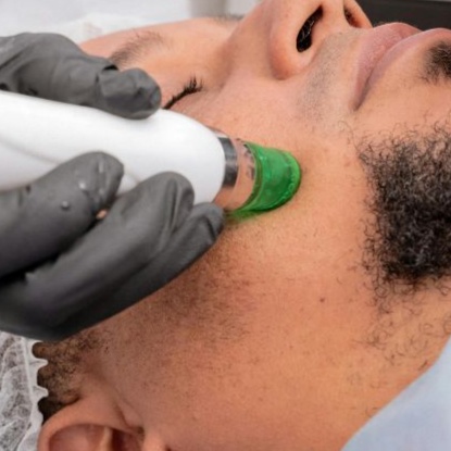 ACNE DEEP CLEANCING FACIAL