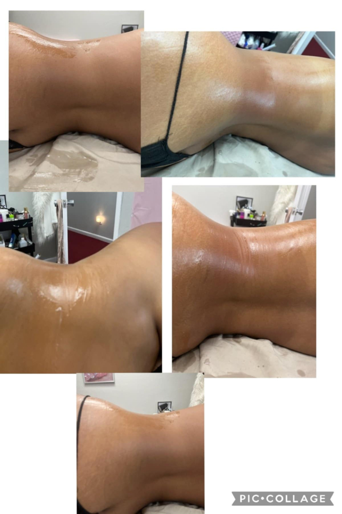 Body Contour Package