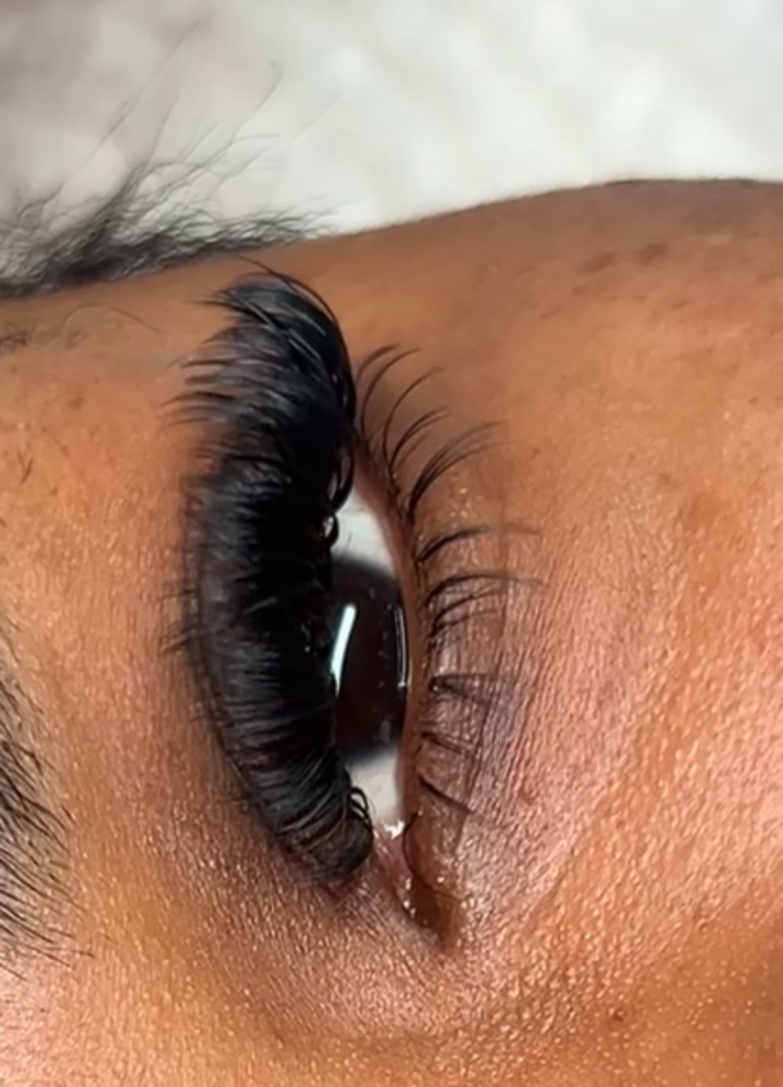 Volume Fill ( 3 Weeks) at Inalas_esthetique in Uniondale, NY
