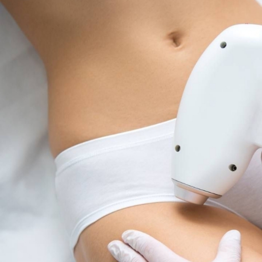 Bikini Laser Hair Removal ✨ at Beauty Refinery LLC in Friendswood, TX