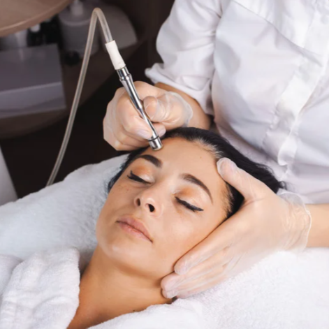 Microdermabrasion