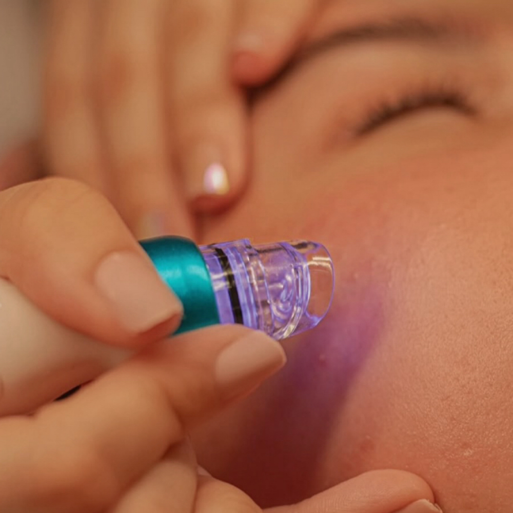 Hydroderm Basic at MySkin Aesthetics in Laredo, TX