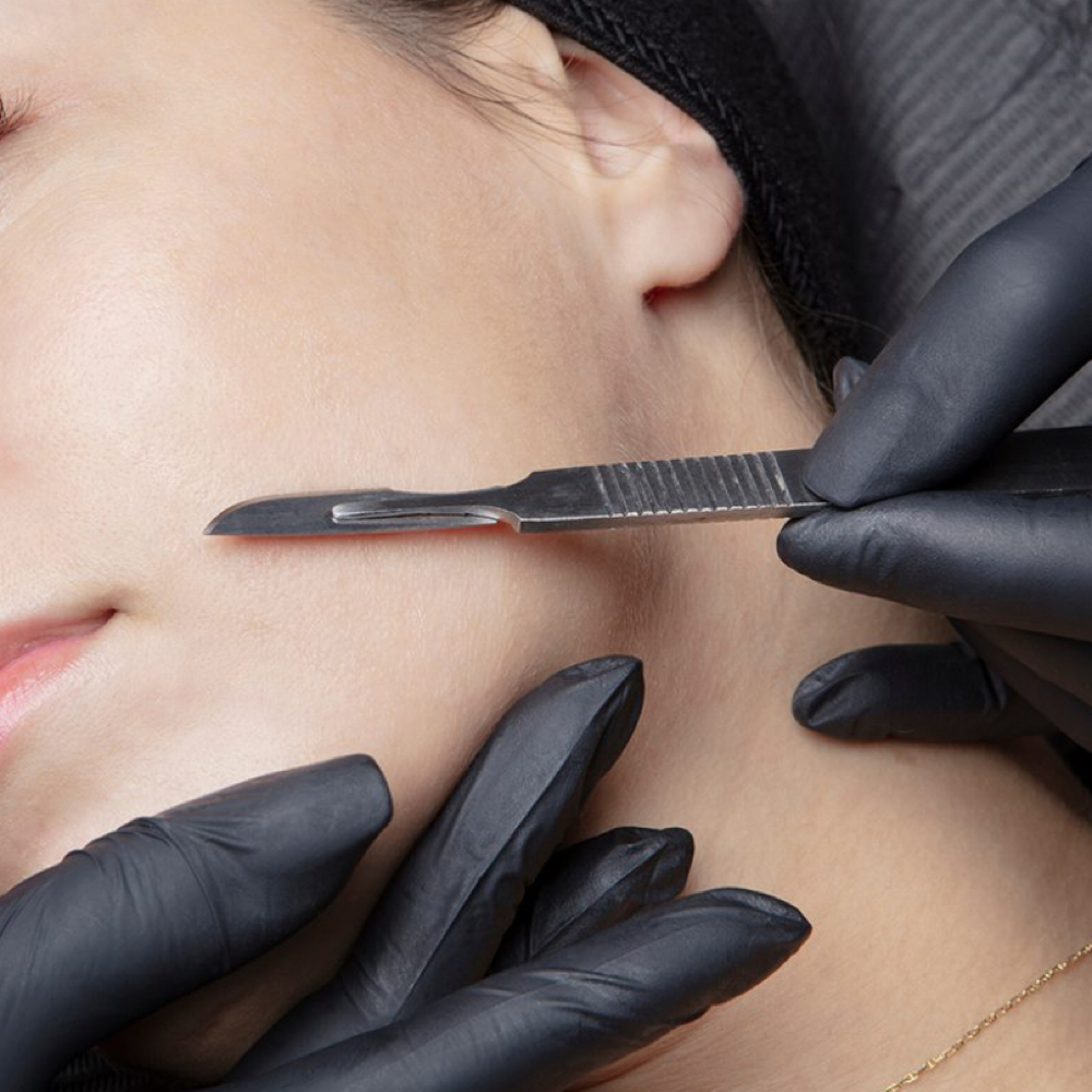 Microderm|Dermaplane - Add On at Brittney Murphy’s Skincare in Windsor, CO