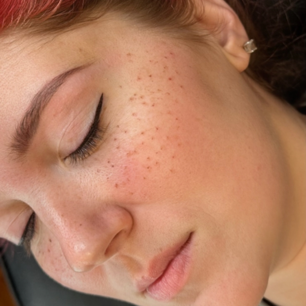 Freckles at Refined Beauty Co in Sparta, TN
