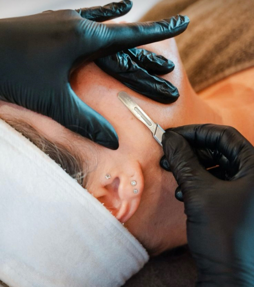 Dermaplaning Facial