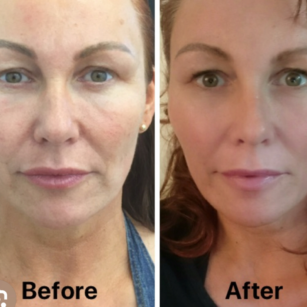 A’new PDO Smoothing Threads