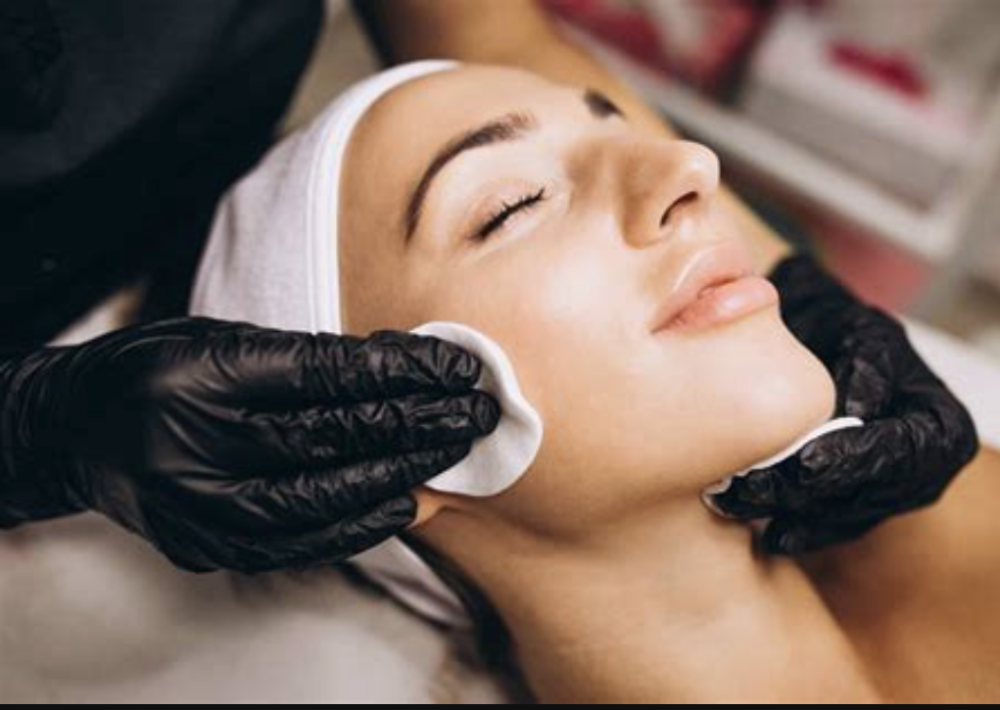 Chemical Peel