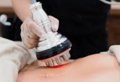 Body Contouring