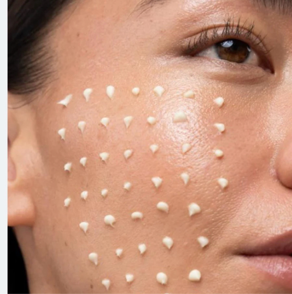 Liquid Microneedling at Bridget  Wilson Skin in Downey, CA