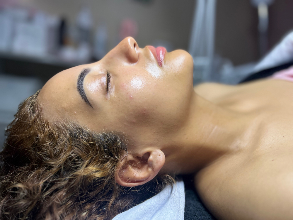 Luminous Veil Peel