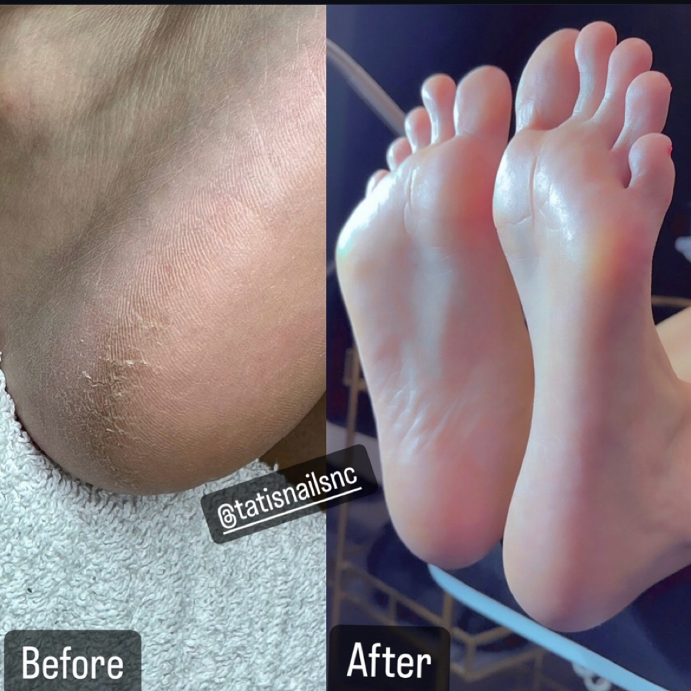 Heel Refresher🦶🏼 at Tatisnailsnc in Raeford, NC