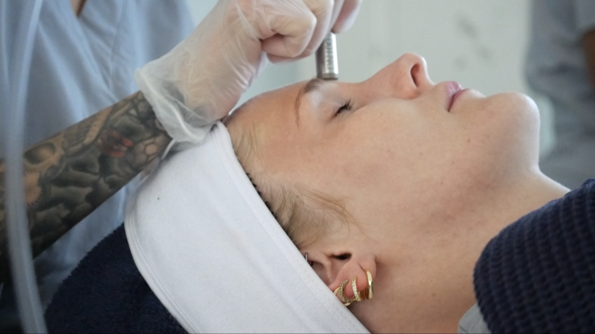 Microdermabrasion Renewal at A1 Aesthetics LLC in Hudson, NY