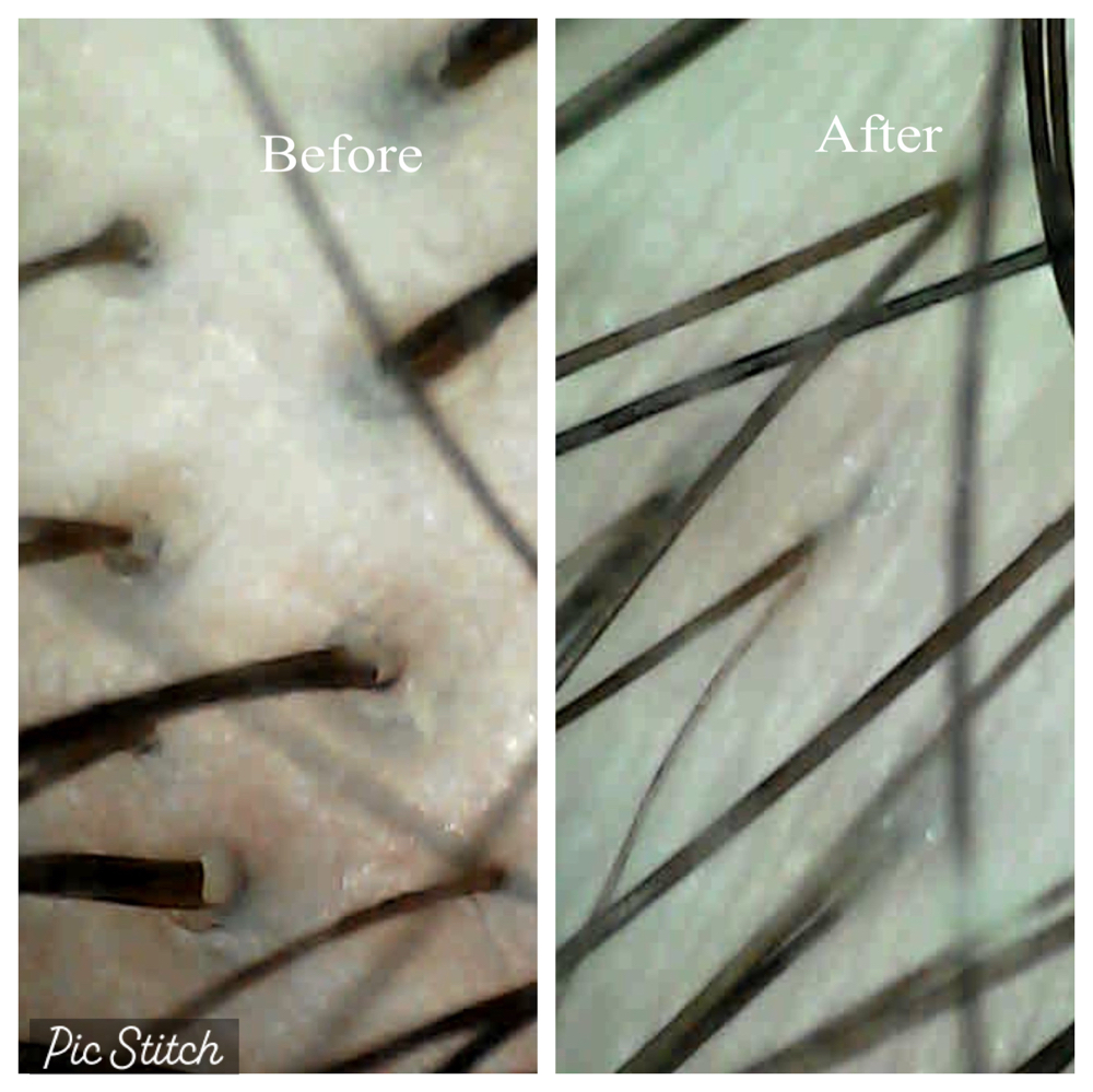 Scalp Scope
