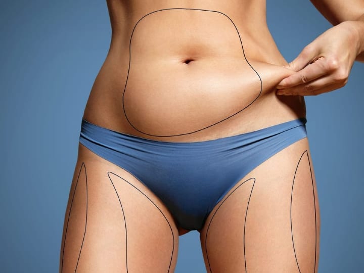 R&B Slimming Treatment (8 sessions)