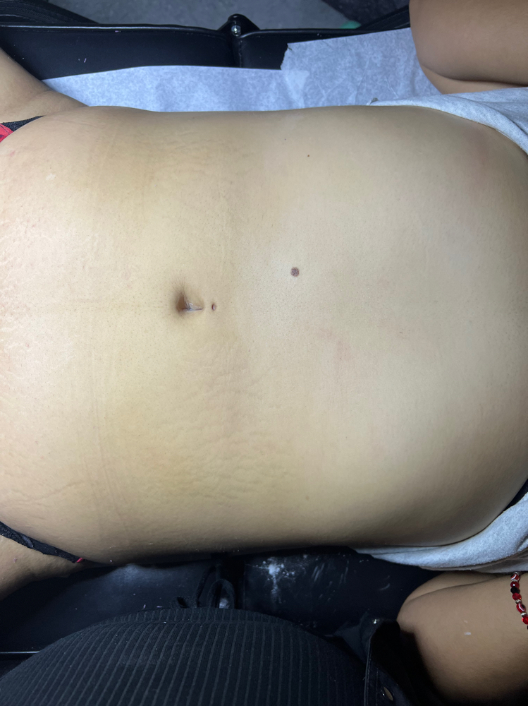 Stomach + Chest Waxing