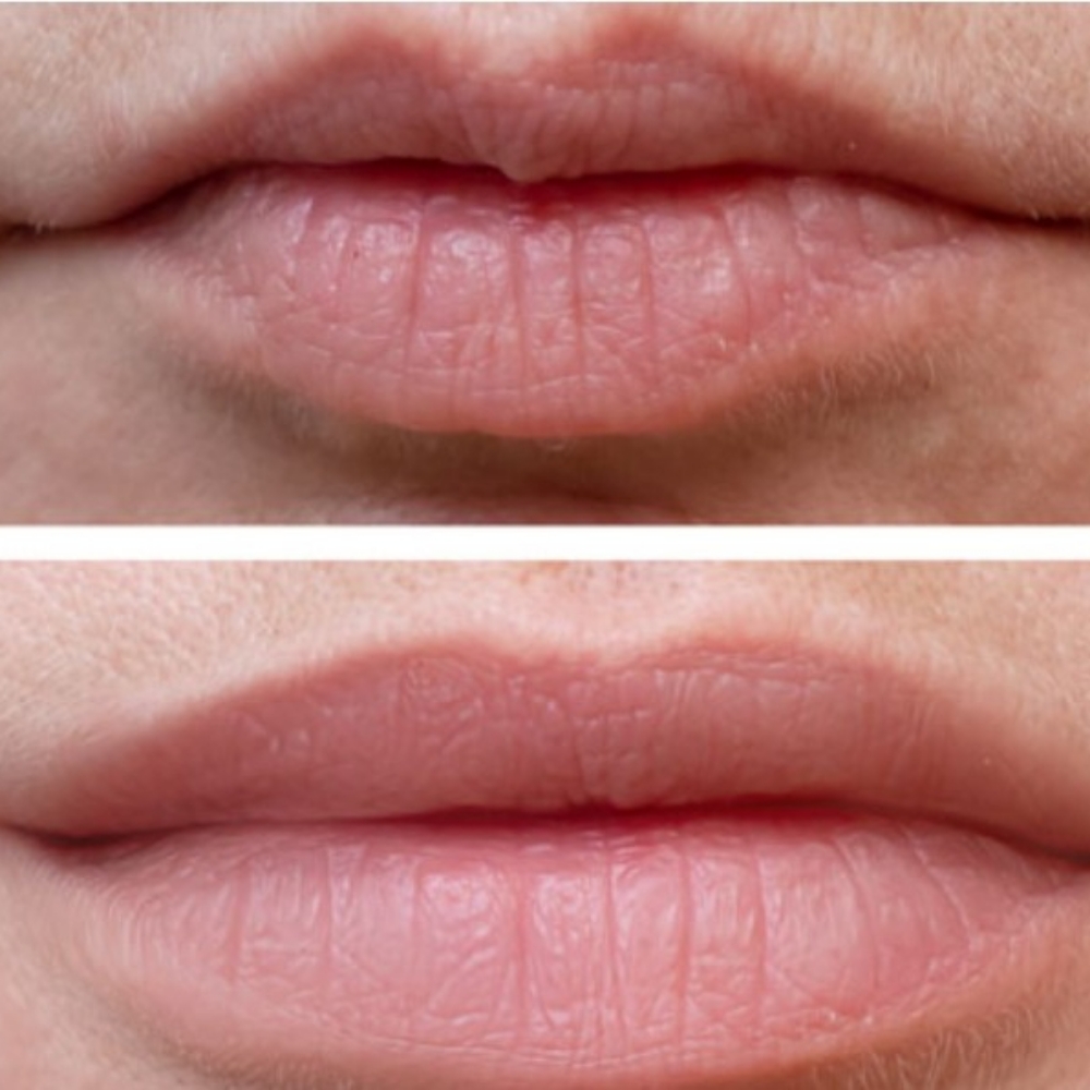 Lip Flip at Beauteous Salon in Liberal, KS