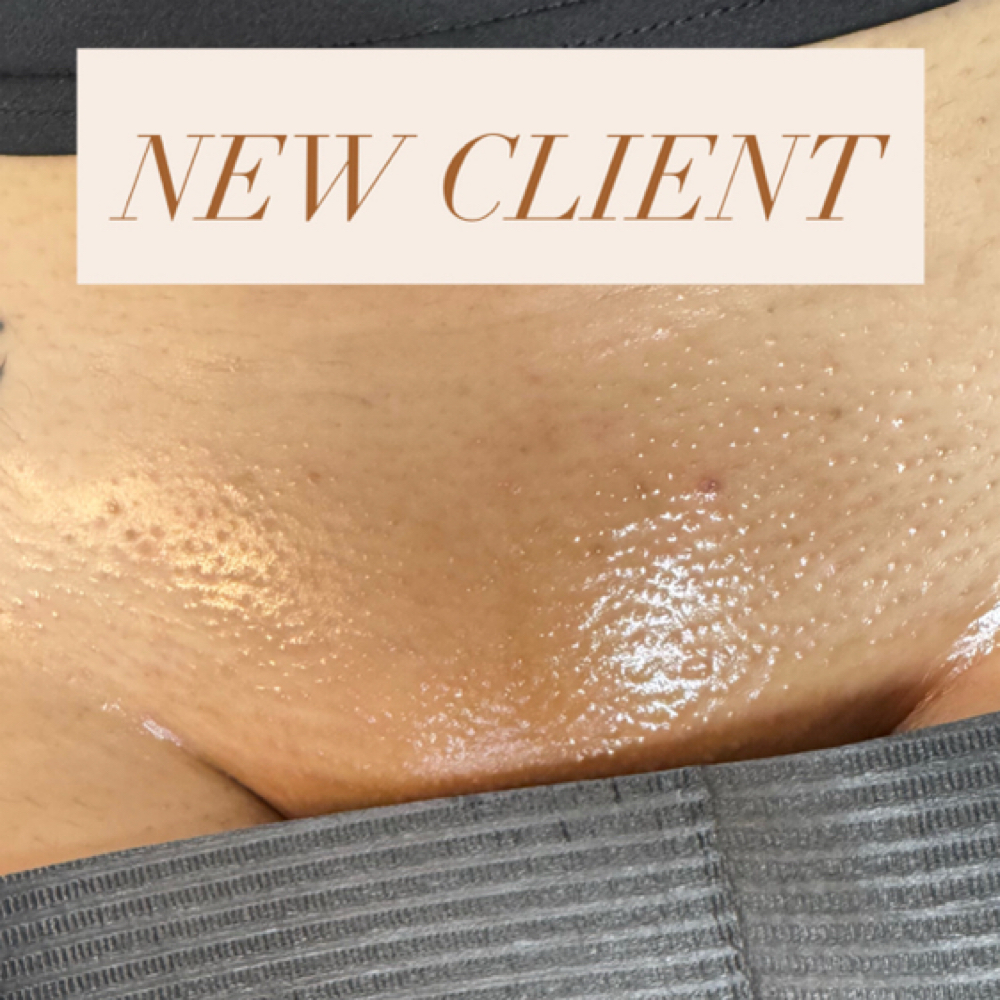 New Client Brazilian at Esthetics By KS in Ontario, CA