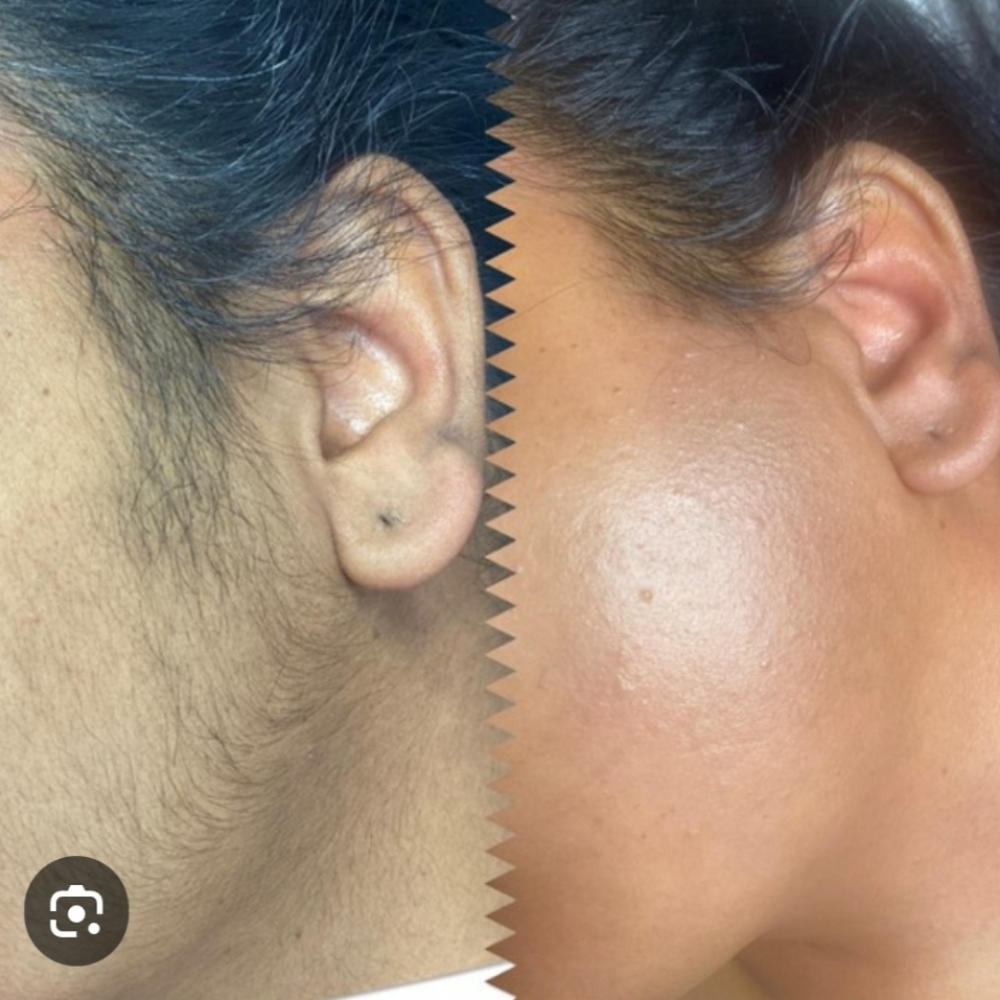 Whole Face Wax at Lumina Brows and Lahes in Riverside, CA